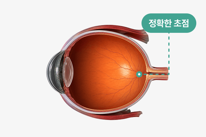 정상 안구